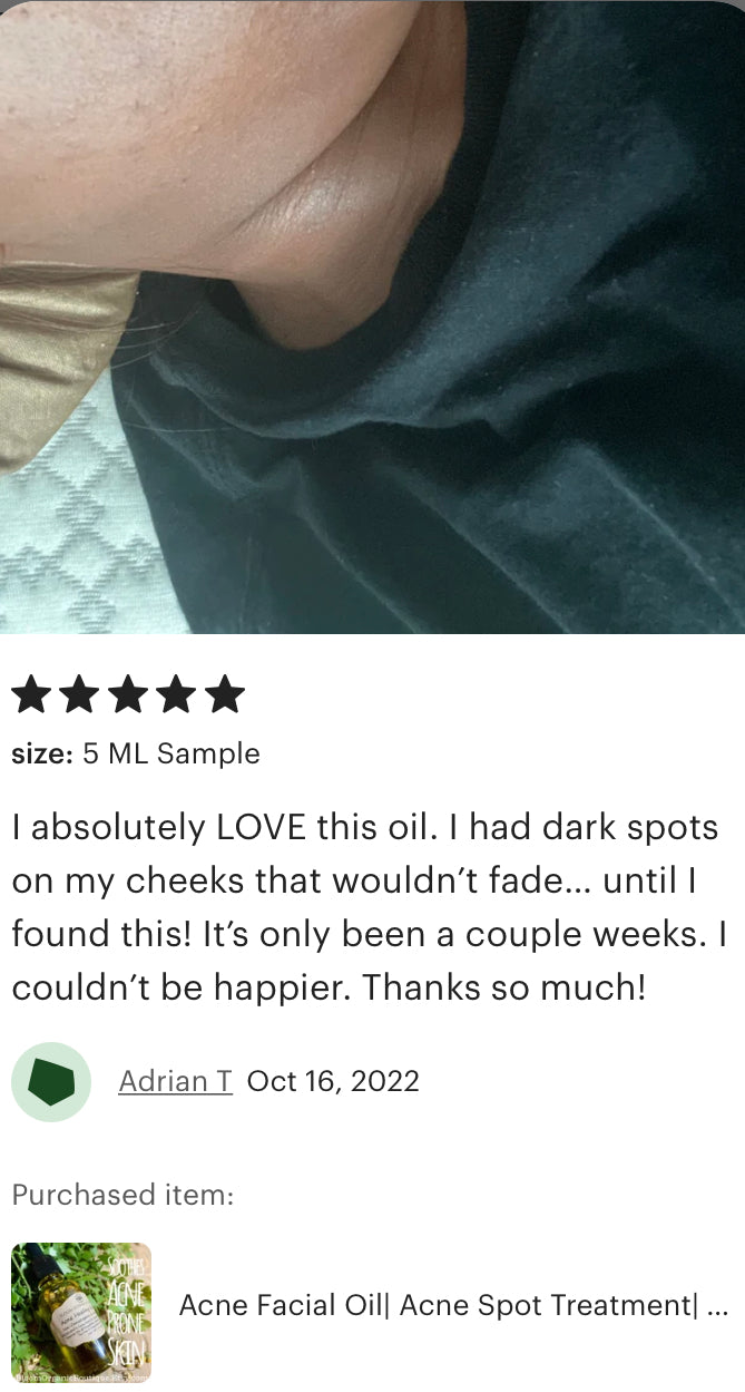 Acne Healing Facial Oil | Acne Prone Skin Care | Proprietary Healing Herbal Blend