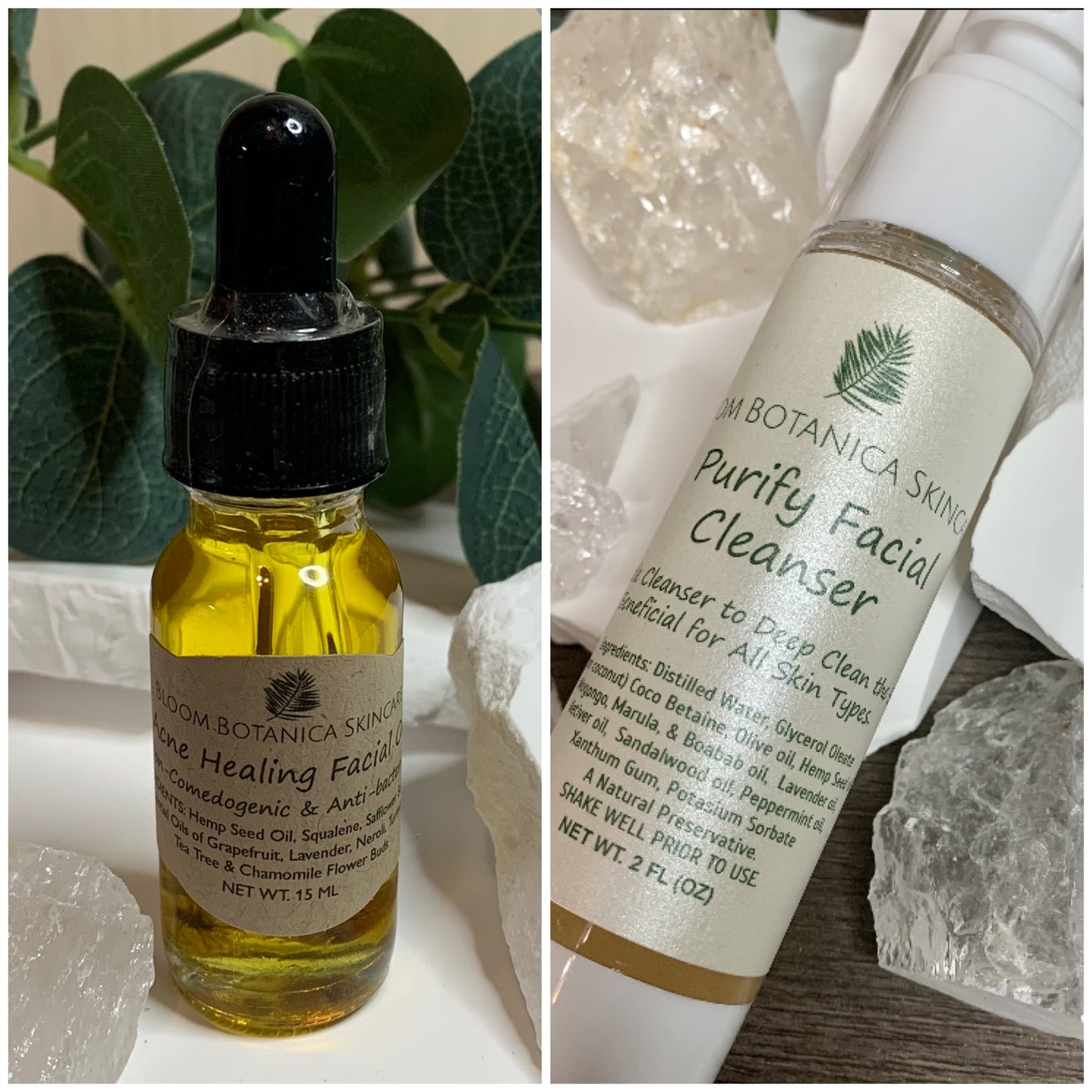 Acne Healing Facial Oil | Acne Prone Skin Care | Proprietary Healing Herbal Blend